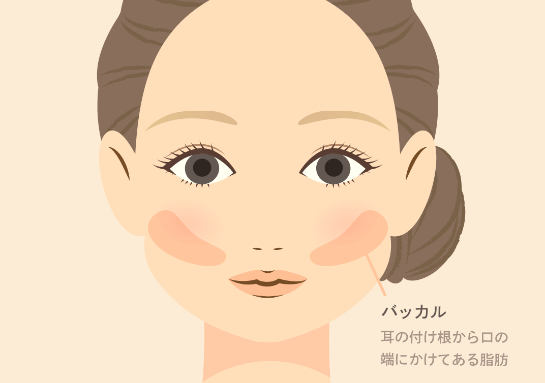 バッカルファット