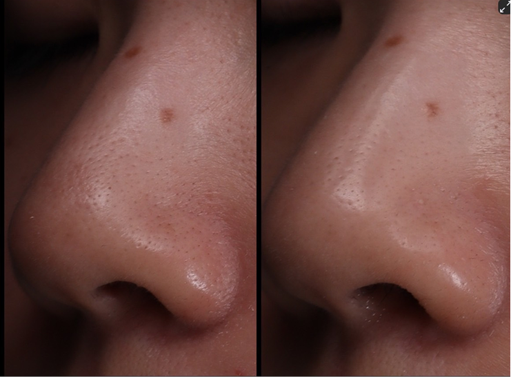 継続できる、美容医療で、根本から肌質改善。