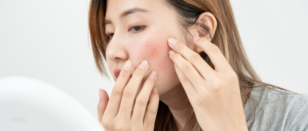 顔の赤みを気にする女性