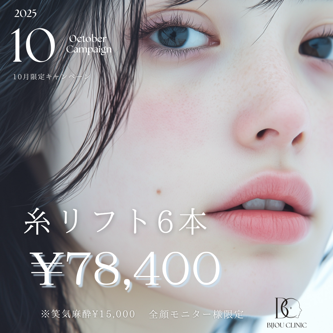 糸リフトキャンペーン