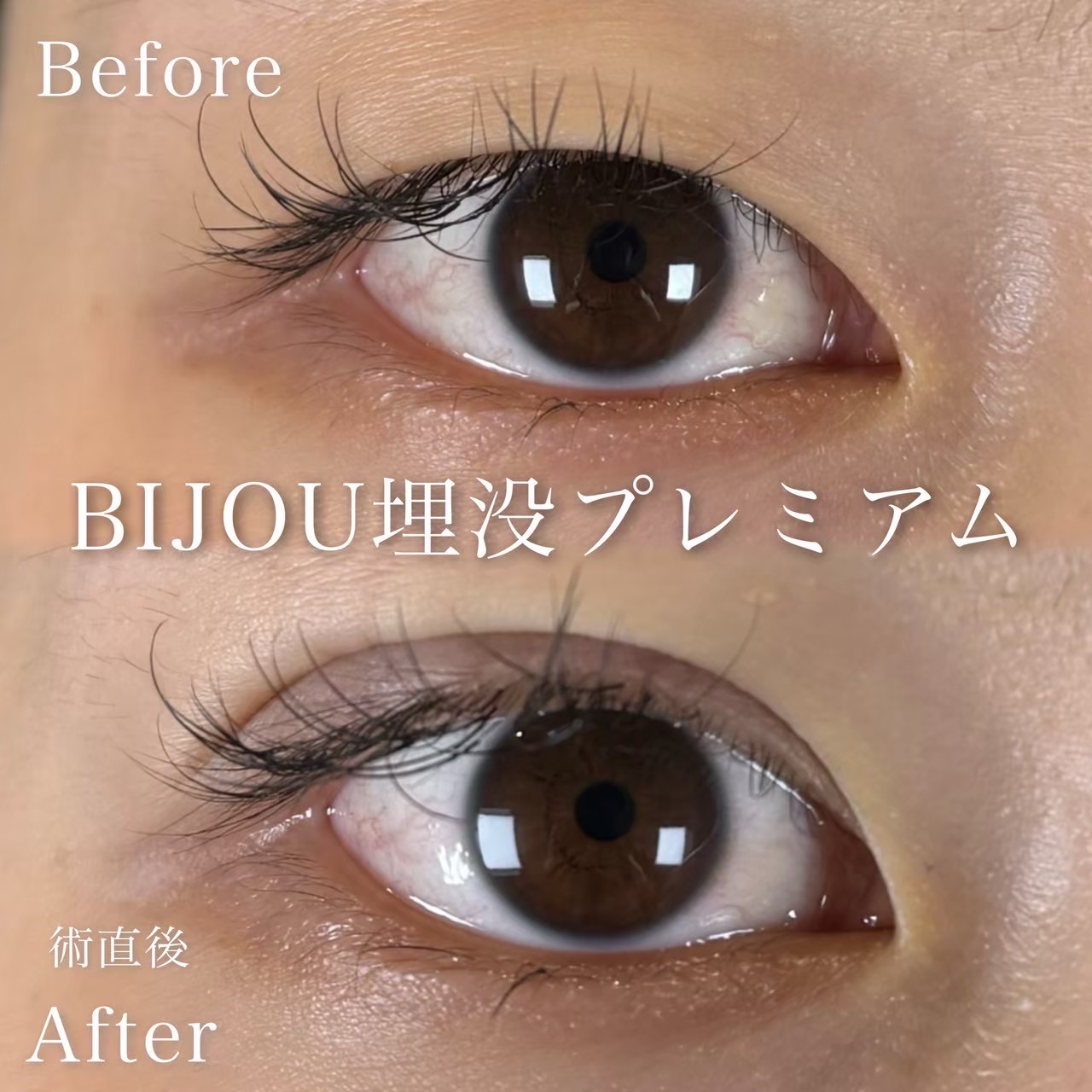 埋没（BIJOUプレミアム）