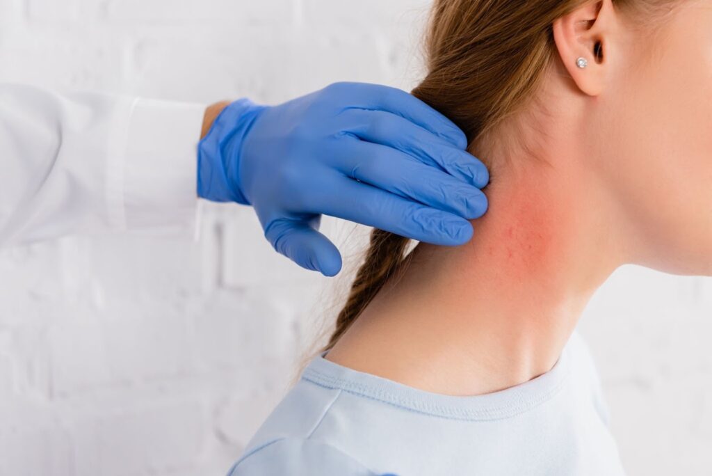 首の赤みを診る医師の手