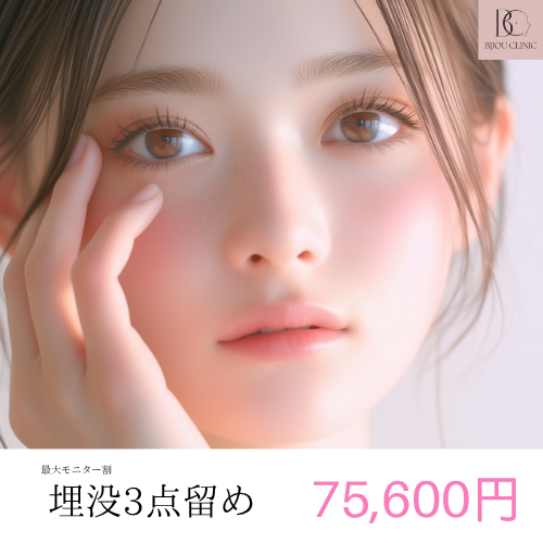 埋没３点留め