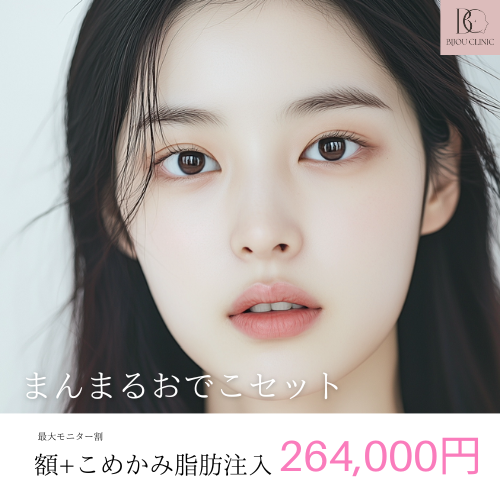 額＋こめかみ脂肪注入