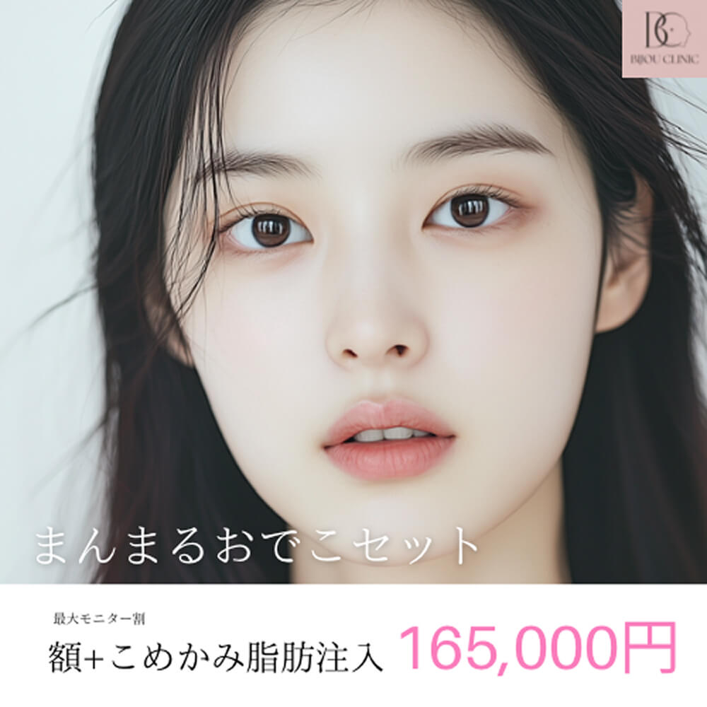 額＋こめかみ脂肪注入