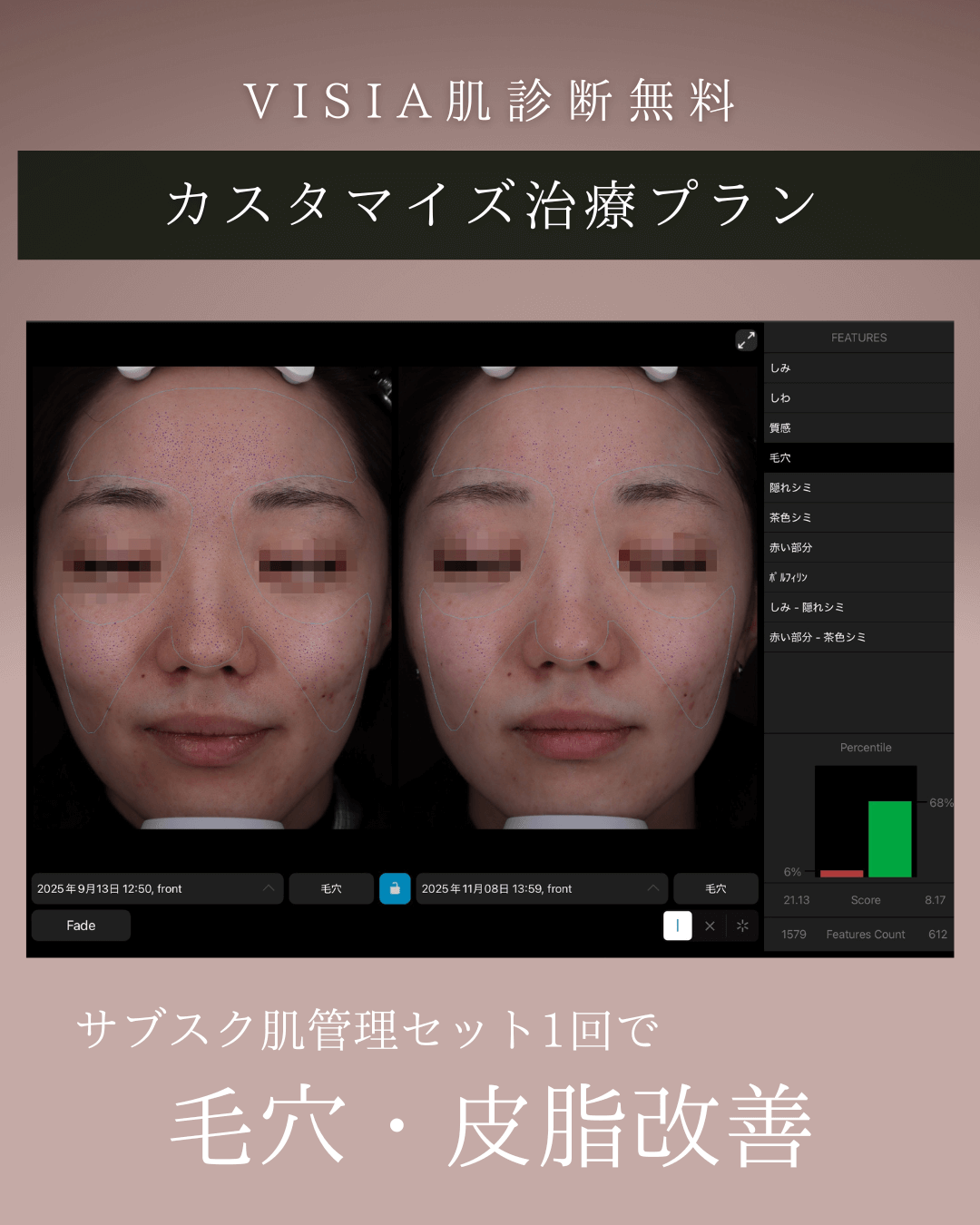 ミラノリピール、ハイドラ、ケアシス