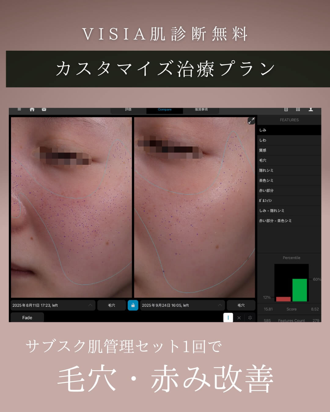 ミラノリピール、ハイドラ、ケアシス