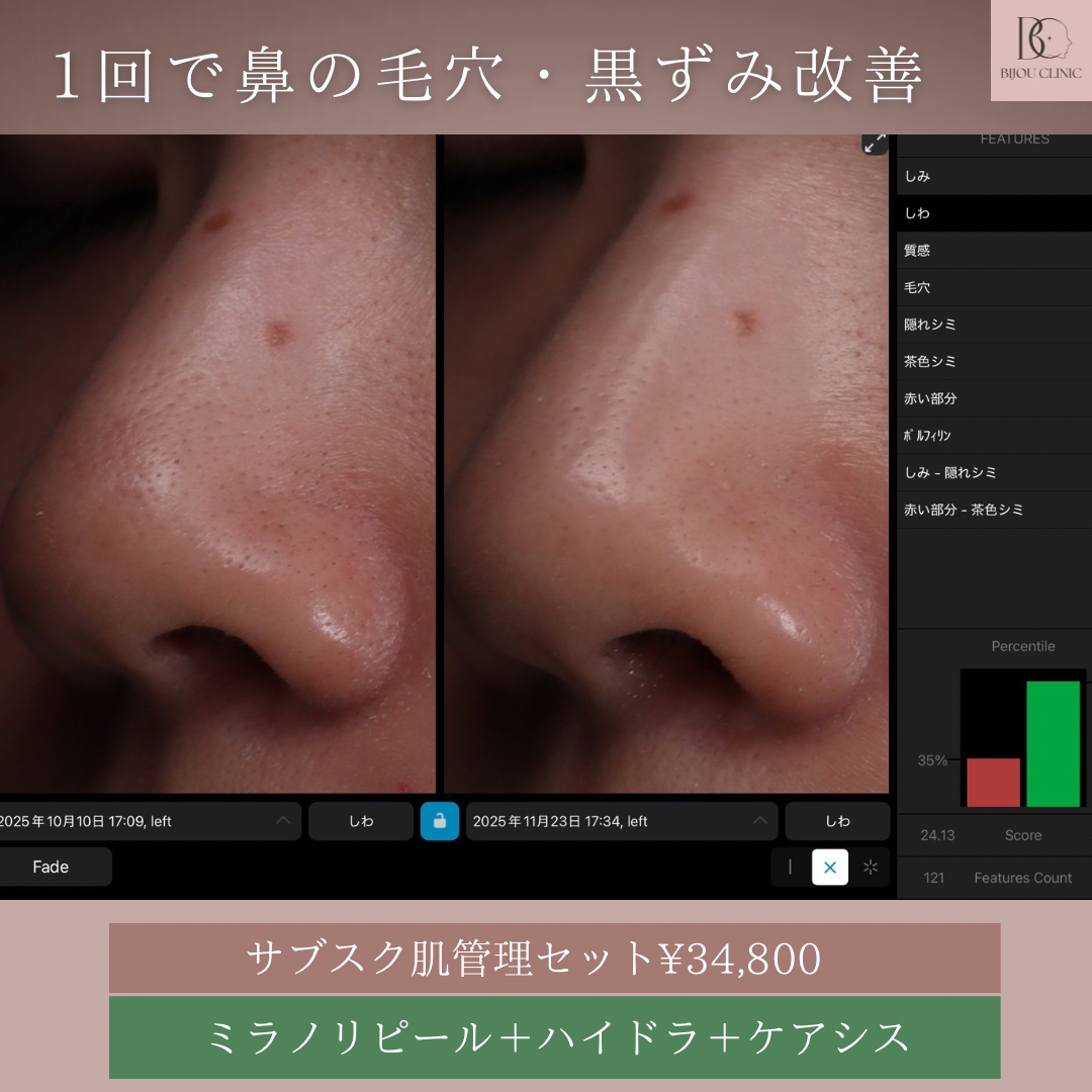 ミラノリピール+ハイドラ+ケアシス