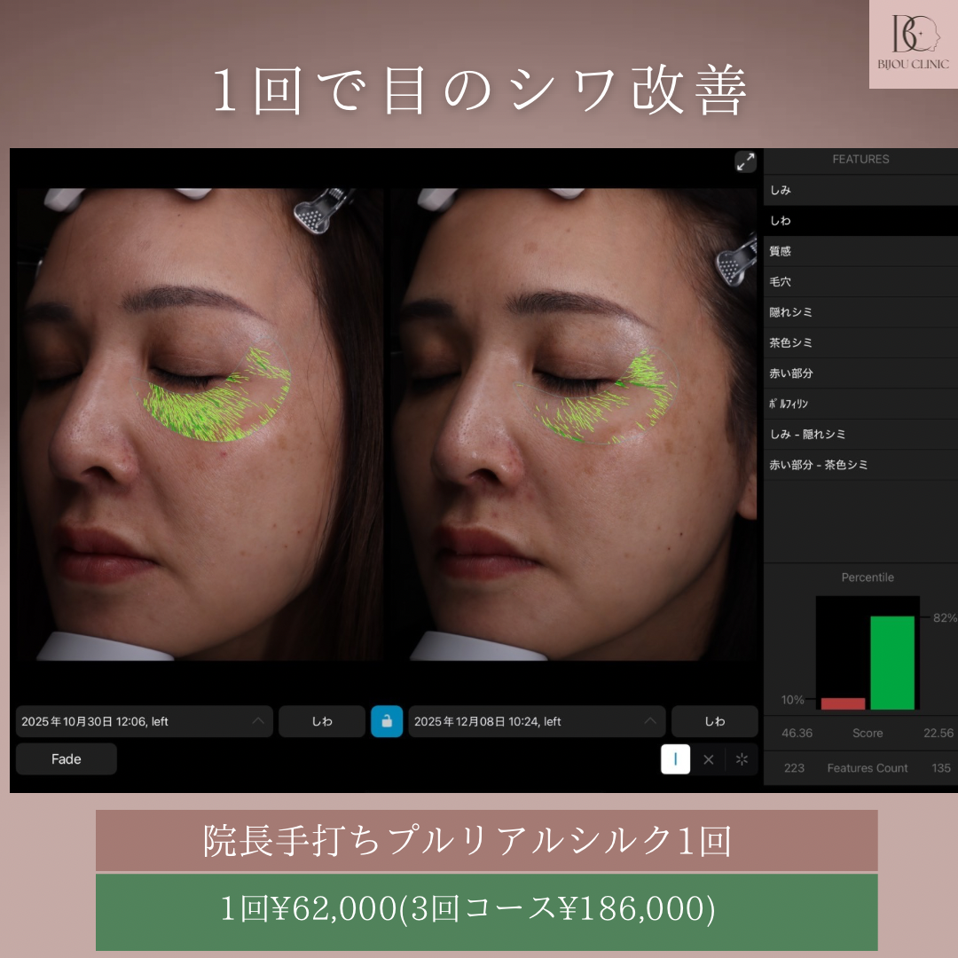 院長手打ちプルリアルシルク1回