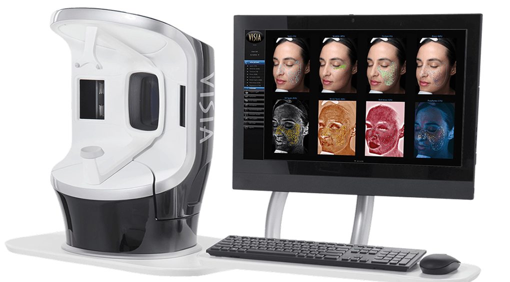 肌診断機VISIA（ビジア）