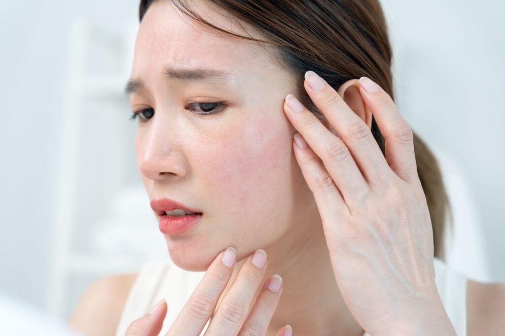 肌トラブルが起きて困っている女性