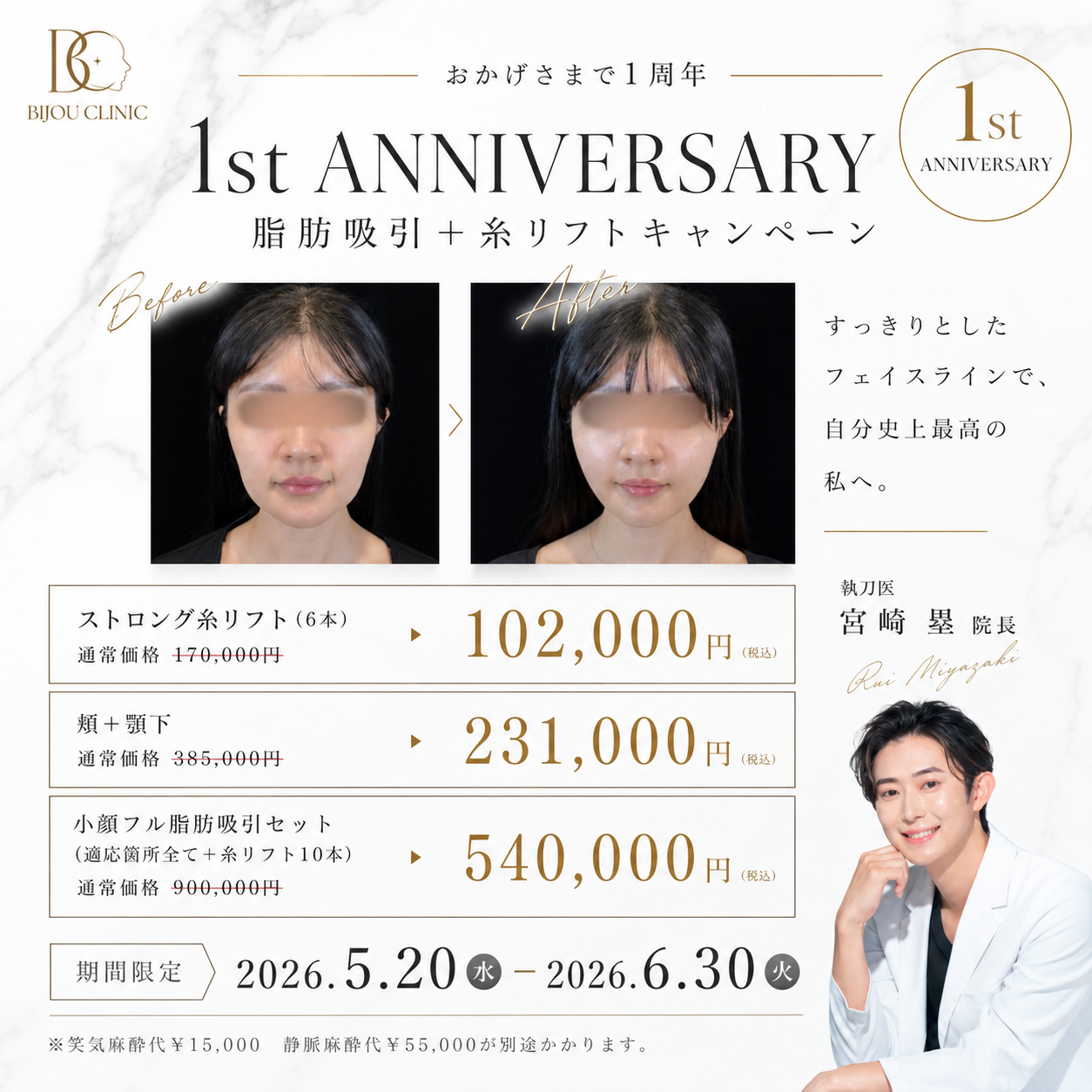 脂肪吸引＋糸リフト