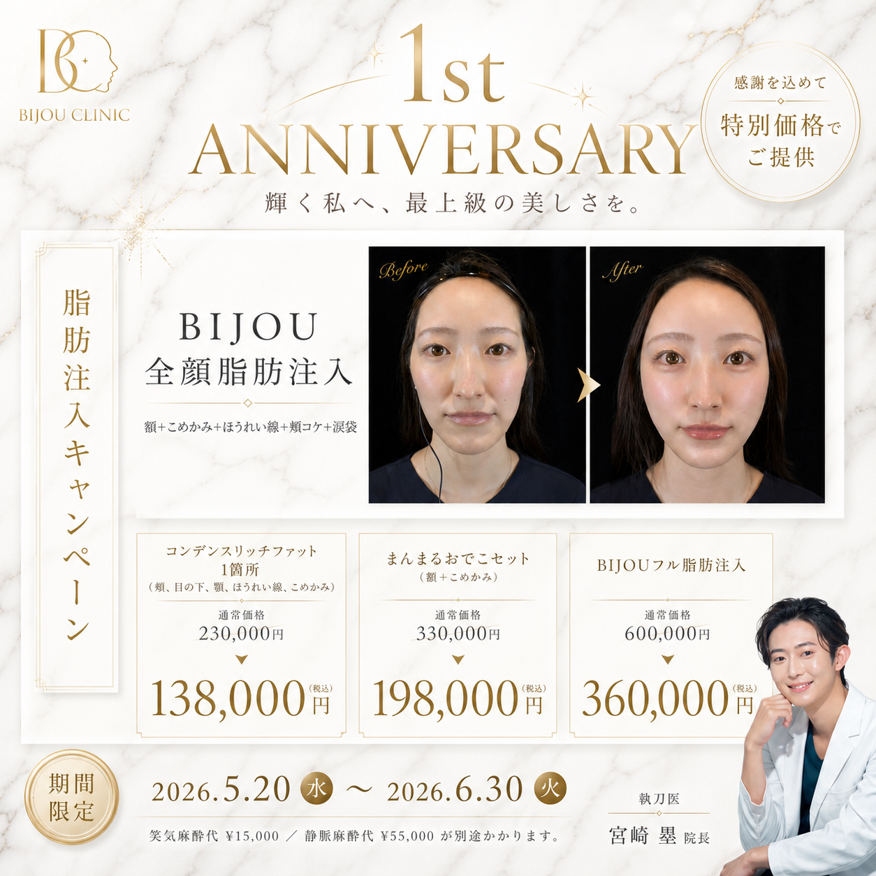 全顔脂肪注入