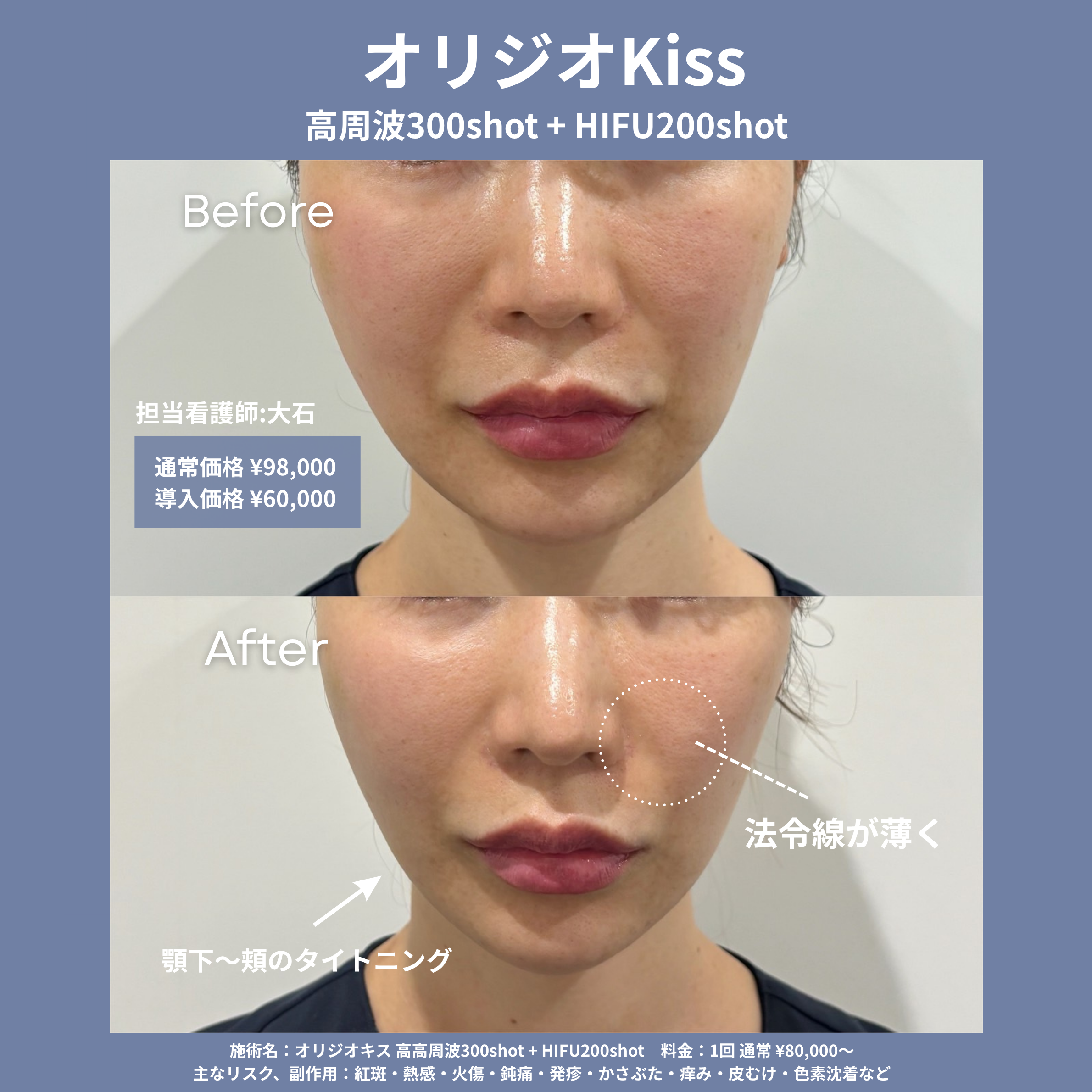 オリジオKISS