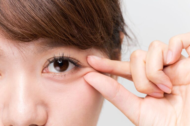 眉下切開でつり目になる？原因と対処法、防ぐためのポイントを解説