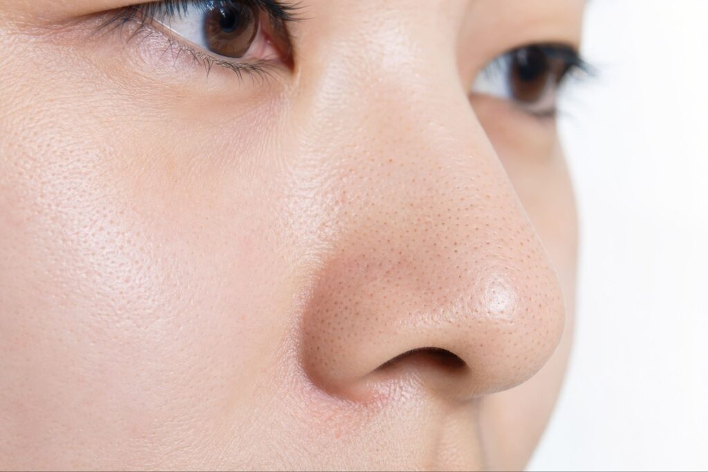 眉下切開と埋没法の順番は？同時・期間を空ける場合について解説