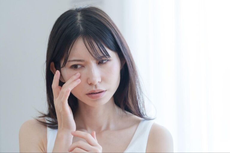 二重埋没の内出血はなぜ起こる？原因や対処法、隠し方など詳しく紹介