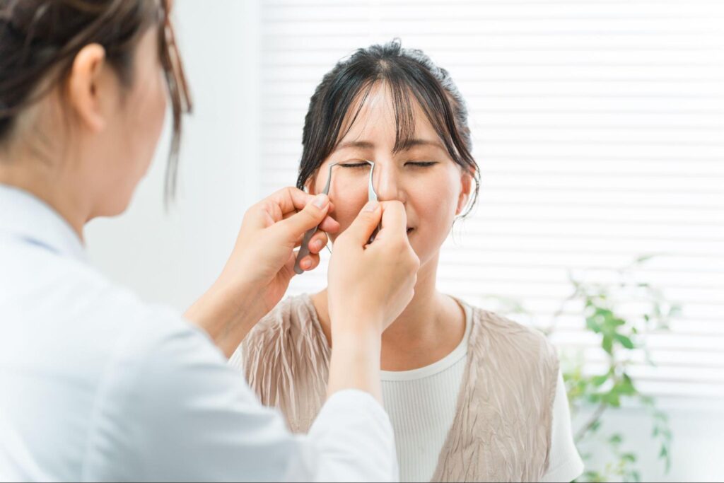 二重埋没 目頭切開